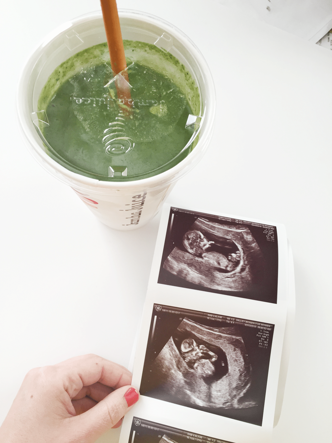 Ultrasound picture next to a green smoothie. 